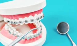 Remboursement orthodontie